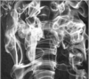 Smoke Image