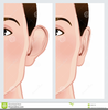 Cosmetic Surgery Clipart Image