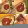 Ovulation Egg Release Image