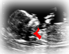 Baby Edit Image