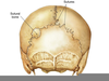 Sutural Bone Image