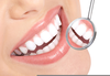 Oral Pathology Clipart Image