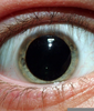 Acid Drug Eyes Image