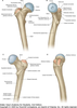 Greater Trochanter Image