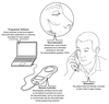 Cluster Headaches Diagram Image