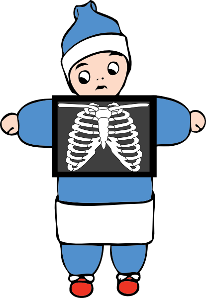 clipart of x ray - photo #1