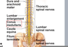 Conus Medullaris Mri Image