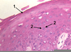 Intercellular Bridges Image