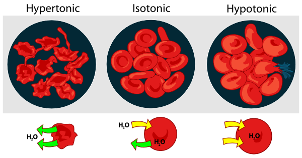 Osmotic Pressure On Blood Cells  By: Mohamed Ibrahim 5.4/10 3 votes