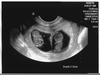 Ultrasound Weeks Image