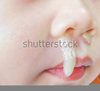 Nose White Mucus Image