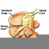 Neural Exit Foramen Image