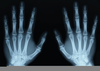 X Rays Image