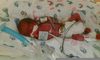 Weeks Preemie Image