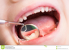 Dentist Mirror Clipart Image