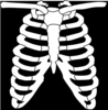 X-ray Clip Art