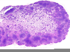 Lymph Node Histology Image
