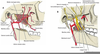 Inferior Alveolar Canal Image