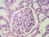 Kidney Slide Glomerulus Image