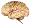 Cerebrolife Image