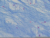 Fibrocartilage Slide X Image