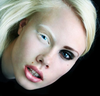 Half Albino People Image