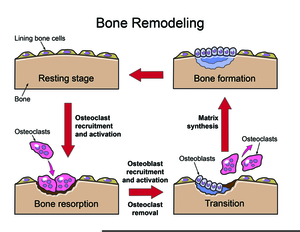 Bone Remodeling | Free Images at  - vector clip art online,  royalty free & public domain