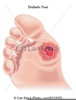 Clipart Foot Medical Image