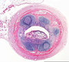 Human Appendix Histology Image