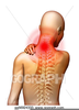 Neck Pain Clipart Image