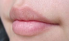 Lip Image