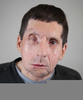 Jim Face Transplant Image