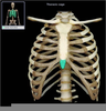 Protruding Xiphoid Process Image