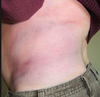 Bruised Side Ribs Image