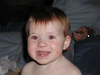 Babies Red Eye Image