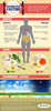 Intermittent Fasting Infographic Image