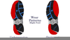 Underpronation Wear Pattern Image