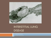 Interstitial Lung Disease Image