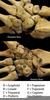Wrist Bones Lateral Image