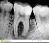 Dental X Ray Clipart Image