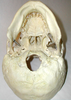 Human Skull Ventral Image