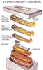 Tutankhamun Coffin Layers Image