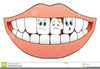 Bad Teeth Clipart Image