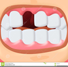 Smile With Missing Teeth Clipart Image