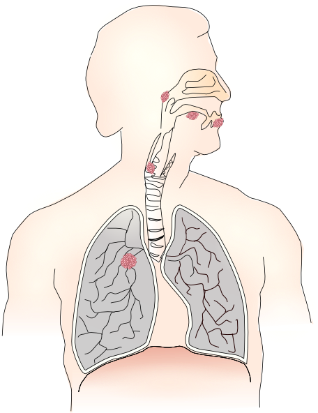 clipart human lungs - photo #37