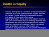 Diabetic Dermopathy Histology Image