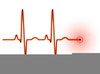 Clipart Ekg Strips Image