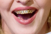 Silver Teeth Image