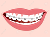 Smiles With Braces Clipart Image