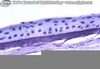 Band Keratopathy Histology Image